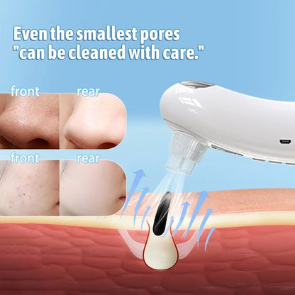 Home Use Beauty Devices Electric Blackhead Instrument Acne Pore Deep Cleaning Instrument New Pore Blackhead Instrument Tool