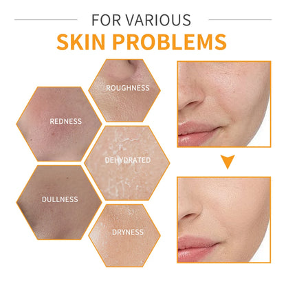 6pcs/set Vitamin C Skin Care Set Deep Cleansing Facial Cleanser Face Cream Moisturizing Anti Wrinkles Face Care Kit Gift Box