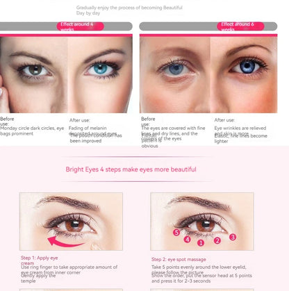 Home Electric Eye Massage Beauty Instrument Exquisite Eye Skin De-Bagging De-Watering Reduce Fine Lines Care Instrument