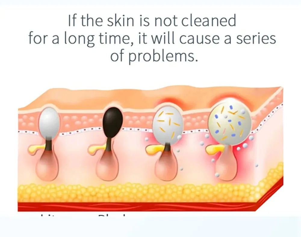 Peeling Beauty Device New Small Bubble Oxygen Injection Instrument Hydra Dermabrasion Aqua Facial Cleaning Suction Blackhead