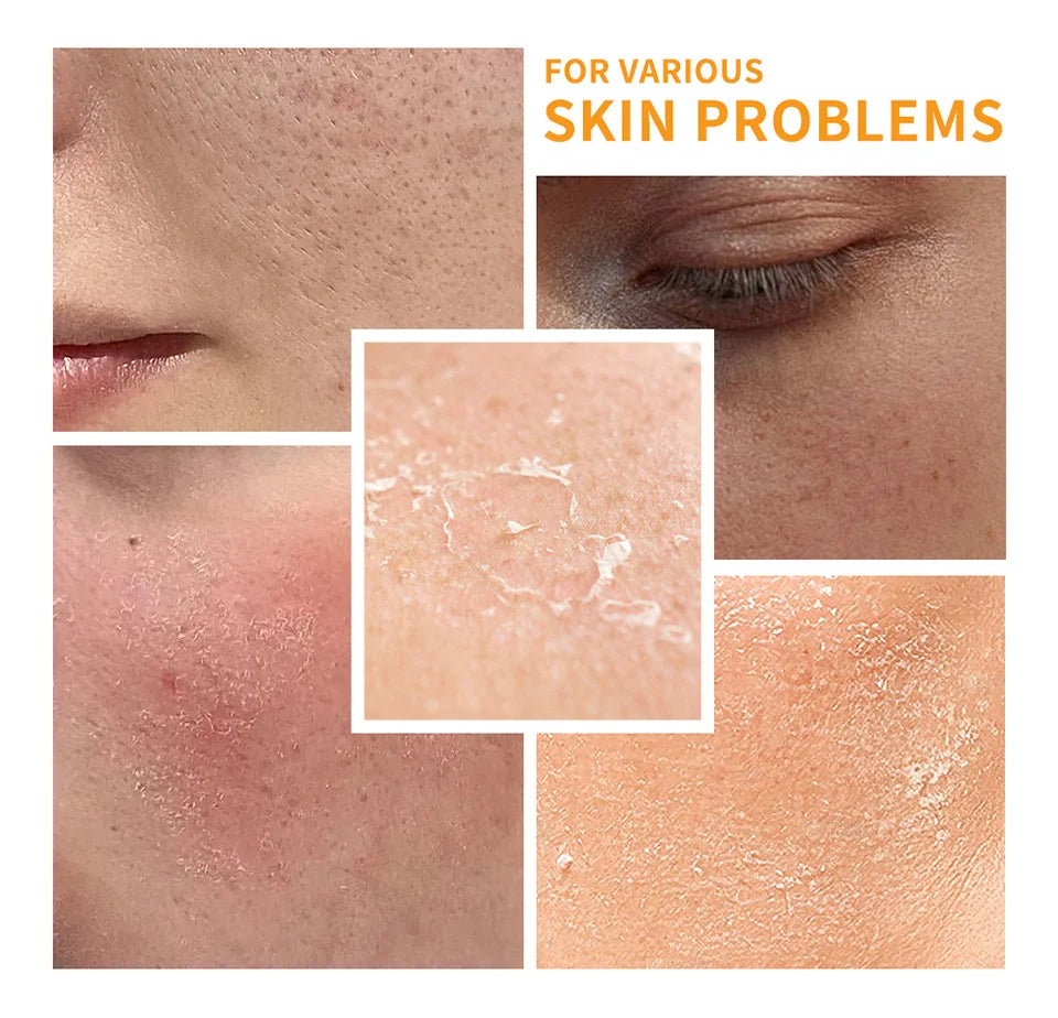 6pcs/set Vitamin C Skin Care Set Deep Cleansing Facial Cleanser Face Cream Moisturizing Anti Wrinkles Face Care Kit Gift Box