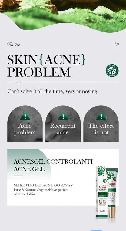 SADOER Tea Tree Acne Removing Cream Facial skincare Oil Control Face Gel Creams Hydrating Moisturizing Facial Cream Skin Care