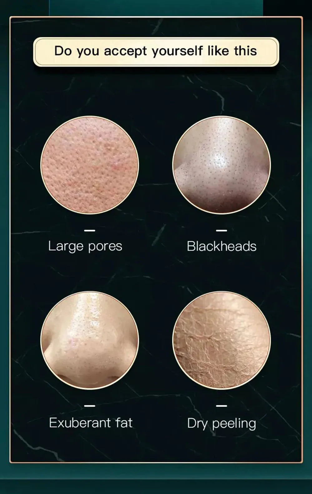 Peeling Beauty Device New Small Bubble Oxygen Injection Instrument Hydra Dermabrasion Aqua Facial Cleaning Suction Blackhead