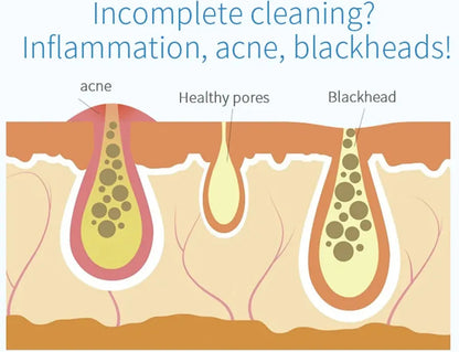 Peeling Beauty Device New Small Bubble Oxygen Injection Instrument Hydra Dermabrasion Aqua Facial Cleaning Suction Blackhead