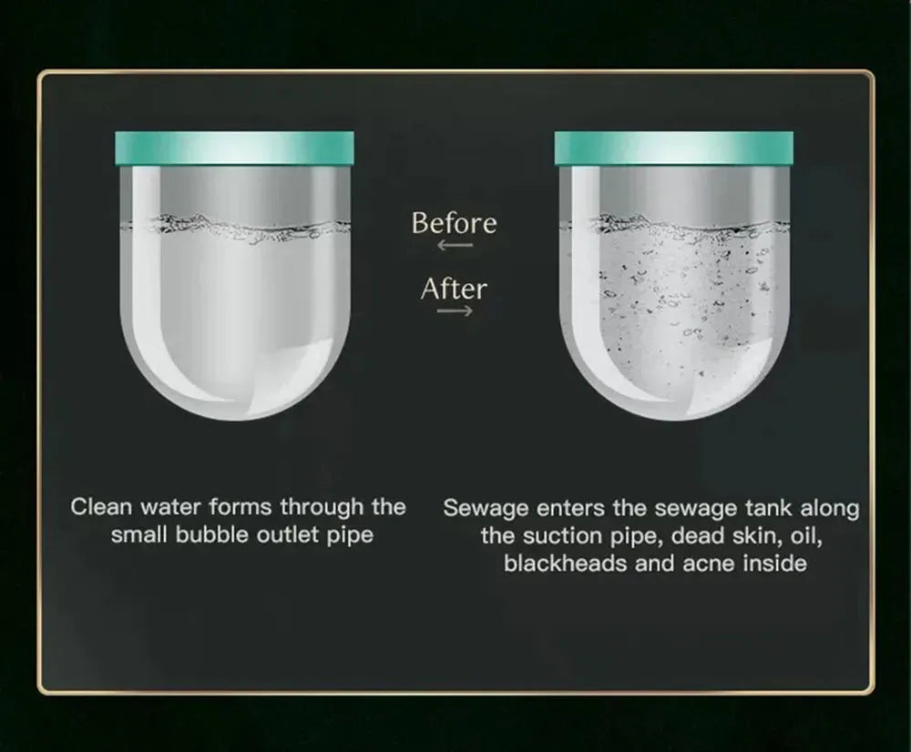 Peeling Beauty Device New Small Bubble Oxygen Injection Instrument Hydra Dermabrasion Aqua Facial Cleaning Suction Blackhead