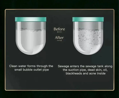 Peeling Beauty Device New Small Bubble Oxygen Injection Instrument Hydra Dermabrasion Aqua Facial Cleaning Suction Blackhead